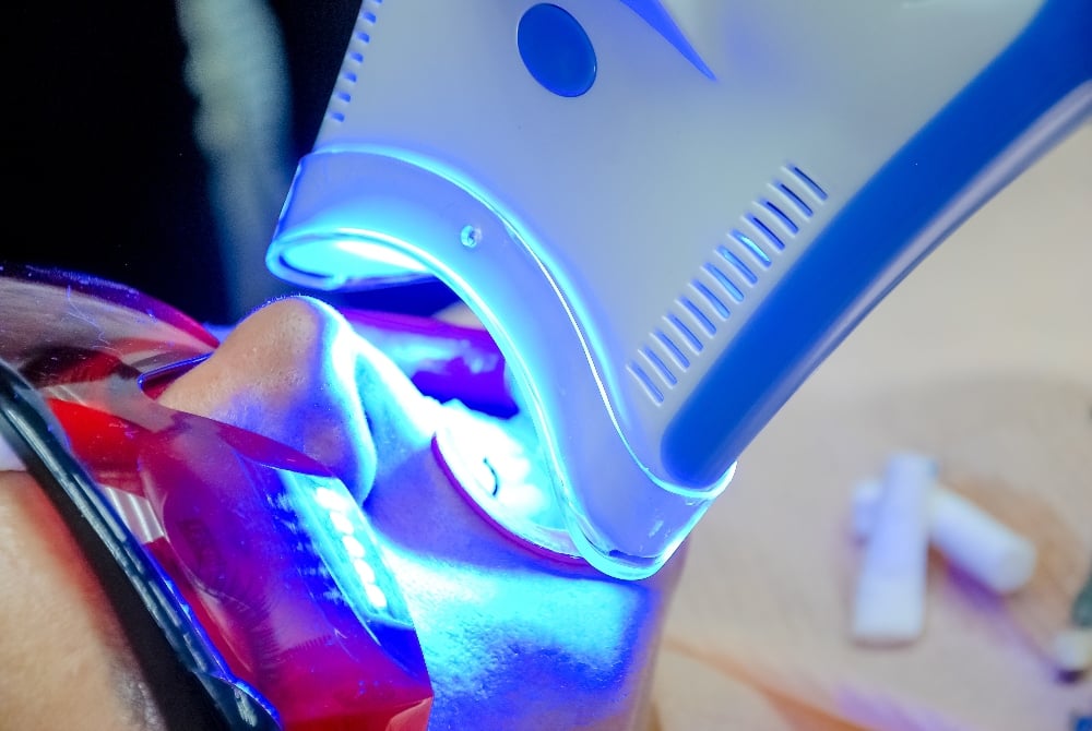 getting-your-laser-dentistry-certification-here-s-what-to-expect